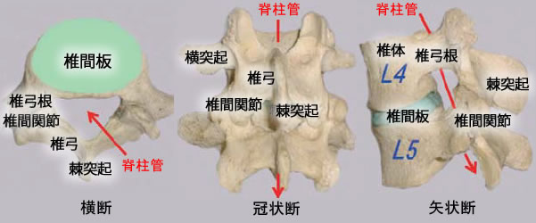 腰部脊柱管狭窄症の特徴と症状01