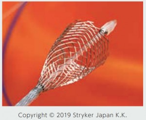 CAS（経皮的頚動脈ステント留置術）イメージ01