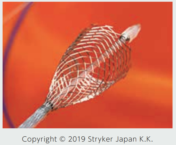 頸動脈ステント留置術にリスクはありますか?