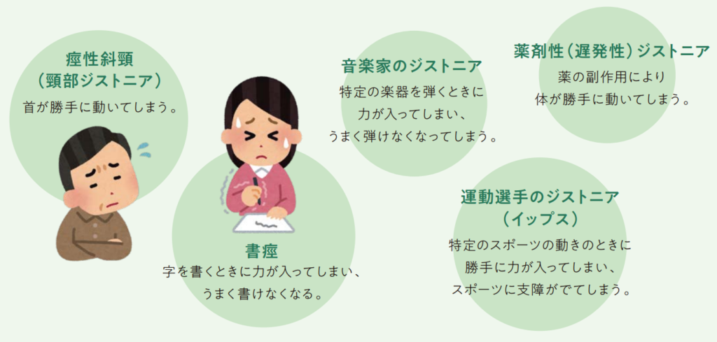 震えとは何ですか?